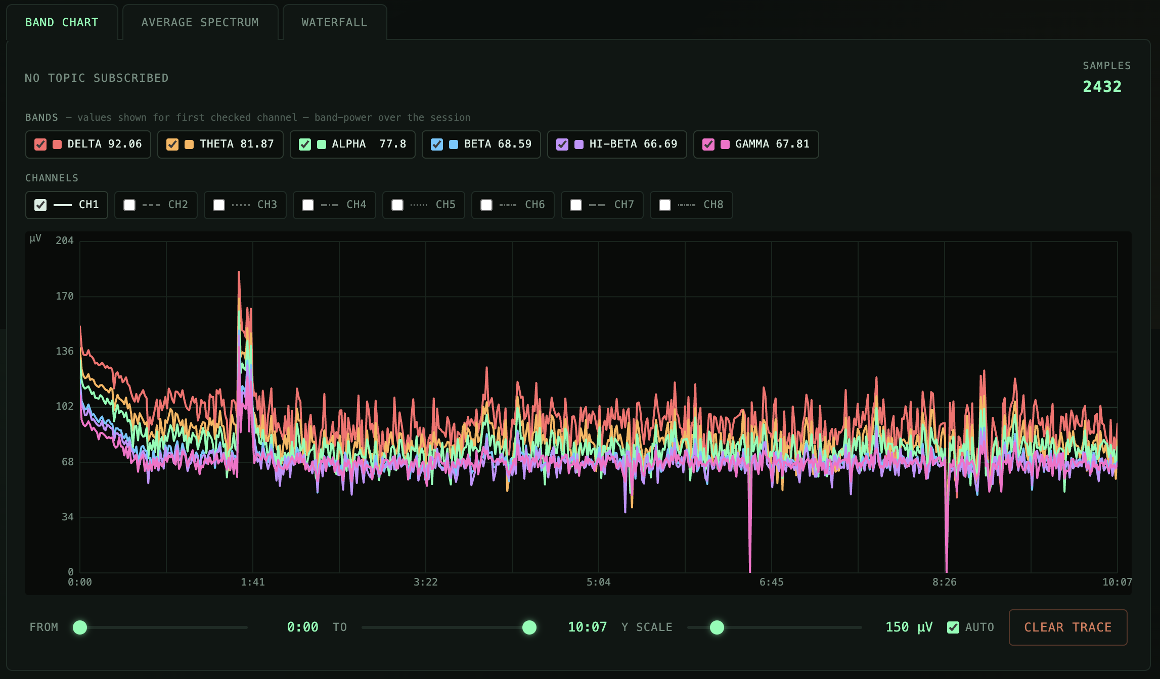 Live EEG band-power chart in the Mindstreams monitor dashboard, showing delta, theta, alpha, beta, hi-beta, and gamma across an active session