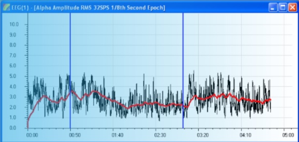 EEG session signal analysis in Vilistus/Pro